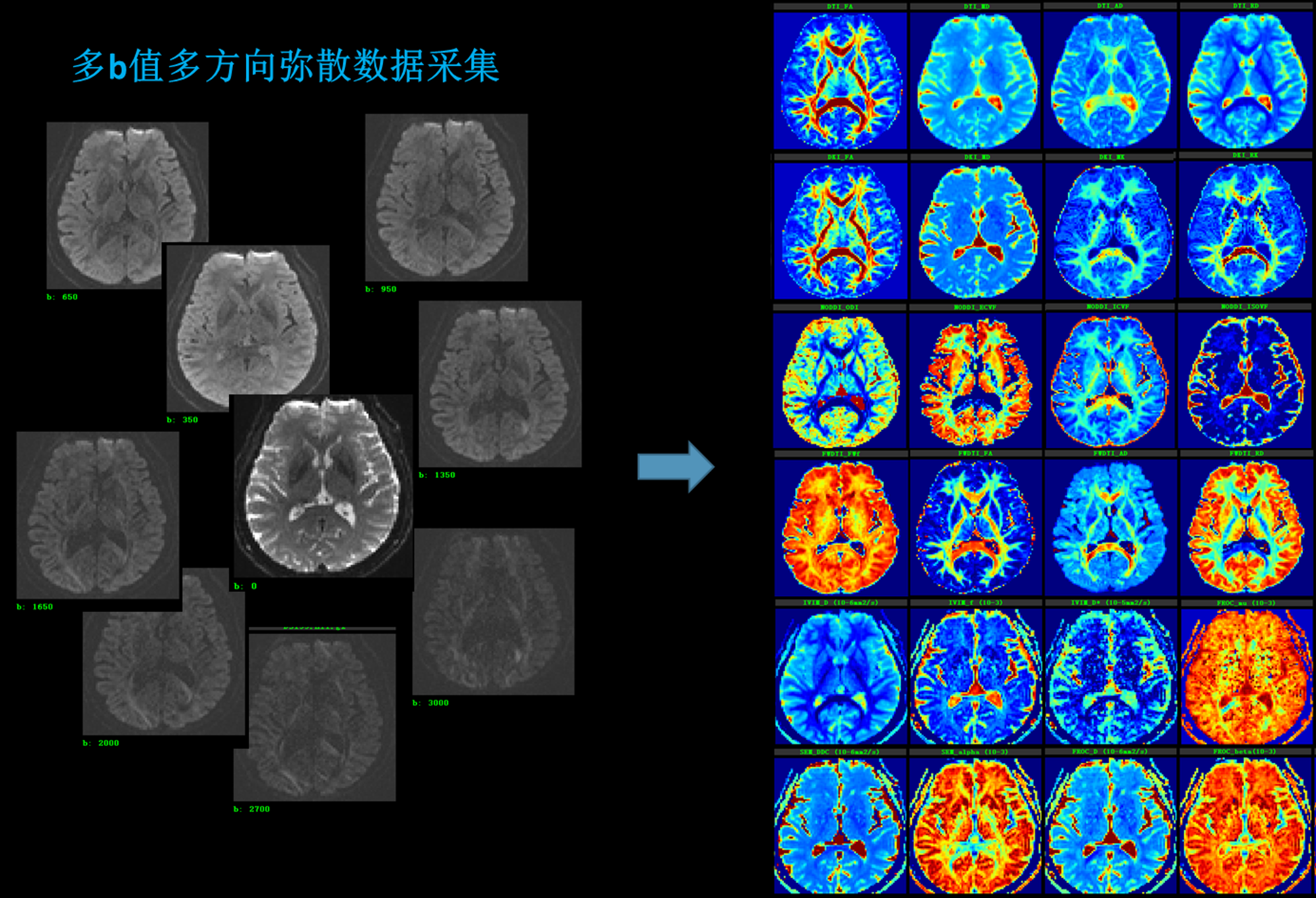 NeuDiLab - 神经弥散高级模型模块