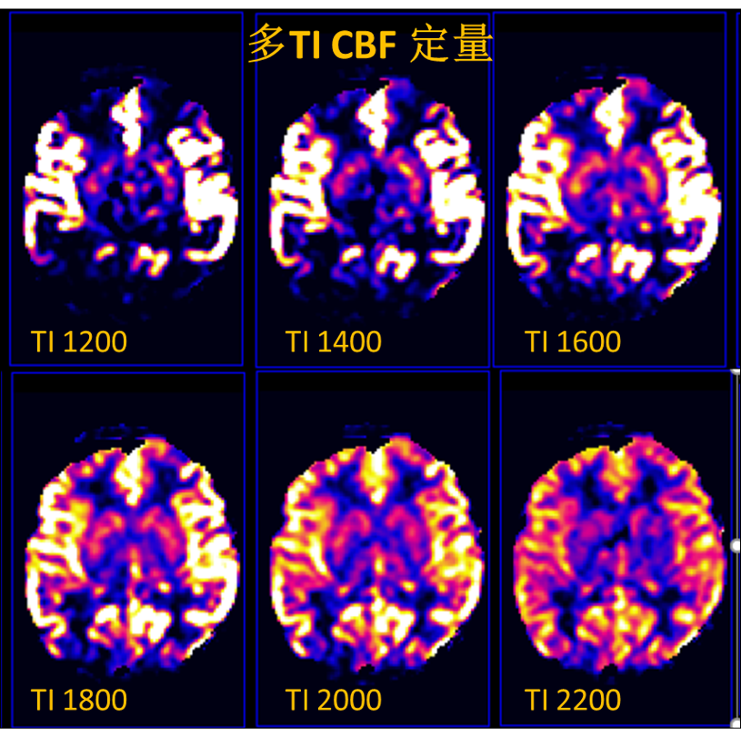 ASLLab - 不打药灌注定量模块