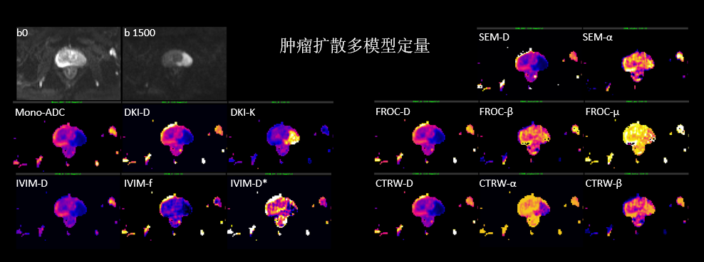 BoDiLab - 体部弥散高级模型模块